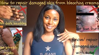 How to repair damaged skin from bleaching creams home remedies to use after bleaching to glow up✨ [upl. by Lleumas451]