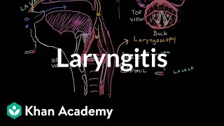 Laryngitis diagnosis treatment and prevention  NCLEXRN  Khan Academy [upl. by Brout]