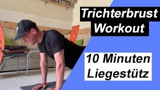 TRICHTERBRUST Workout  10 Minuten LIEGESTÜTZ [upl. by Zela888]