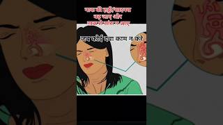 साइनसनाक की हड्डी बढ़ जाना । Sinus Treatment। Nak ki Haddi Ka Badha।sinuses sinusitistreatment [upl. by Richella495]