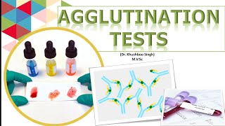 Types of Agglutination tests [upl. by Ymiaj]