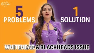 5 Problems One Solution  whitehead and blackheads issue  sweating Problem  Best Dermatologist [upl. by Moorefield236]