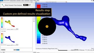 ANSYS ACT Global Update ANSYS 17 [upl. by Pitts]