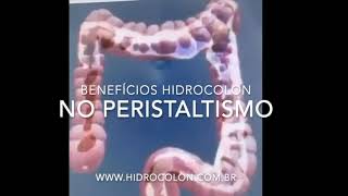 Beneficios da Hidrocolon no Peristaltismo [upl. by Adnaloy]