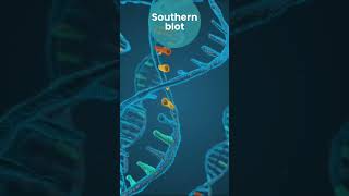 Southern blot Western blot Northern blotEastern blot [upl. by Aidnyl]