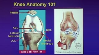 Common Traumatic Knee Injuries Oh My Aching Knee [upl. by Oballa278]