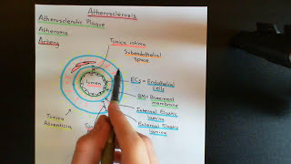 Atherosclerosis Part 1 [upl. by Grimona812]