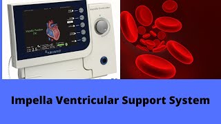 Impella Ventricular Support System [upl. by Rebane]