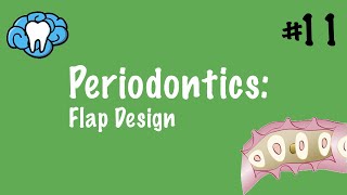 Periodontics  Flap Design  INBDE ADAT [upl. by Benedicto]