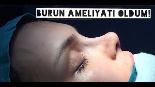 BURUN AMELİYATI OLDUM  EstetikDeviasyon Fotoğraflarla Ameliyat Süreci [upl. by Wemolohtrab]