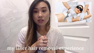 MY BRAZILIAN LASER HAIR REMOVAL EXPERIENCE PART 1  heycarmen [upl. by Minsk]