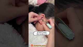 Worried About QTip Dangers Try the Baby Ear Cleaning Tool with Light babycare earwaxremoval [upl. by Leirbag439]