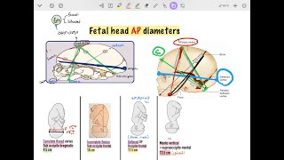 Fetal head diameters [upl. by Ylenaj]