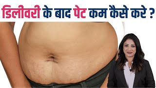 डिलीवरी के बाद पेट कम कैसे करे  How to Reduce Belly Fat after Pregnancy [upl. by Watt]