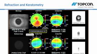 Topcon KR 1W wavefront amp topography system [upl. by Leynad]