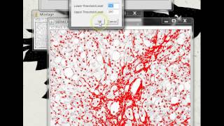 Quantifying Stained Liver Tissue Area Using ImageJ [upl. by Hopfinger441]