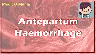 Antepartum Hemorrhage  APH Management प्रसवपूर्व रक्तस्राव प्रबंधन HINDI [upl. by Michale]