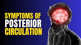 Posterior Circulation Stroke  Recognizing the Silent Symptoms [upl. by Theresina490]