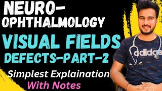 Visual Field Defect2Lesions Of Visual PathwayNEUROOPHTHALMOLOGY [upl. by Hsitirb]