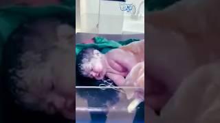 🚼 Reanimación Neonatal en sala de partos 5 Estimulación y RCP neonatal rcp acls reciennacido [upl. by Dirraj]