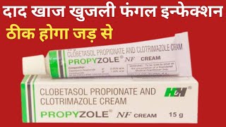 Propyzole NF Cream Uses  Clobetasol Propionate And Clotrimazole Cream  Fungul Infection दाद [upl. by Damha]