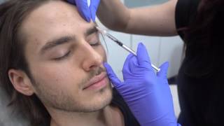 Preventative Glabella Dysport on Male Client [upl. by Lemaceon240]