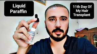 11th Day Of My Hair Transplant  Liquid Paraffin  hairtransplant hair foryou viral youtube [upl. by Wiatt516]