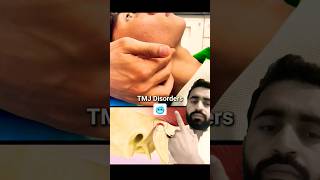 Temporomandibular joint disorder tmjtmjdisorder dentist dental [upl. by Kata513]