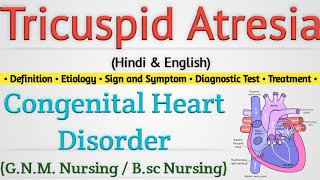 Tricuspid Atresia  Tricuspid Atresia In Hindi  Congenital Heart Disease [upl. by Ettegroeg748]