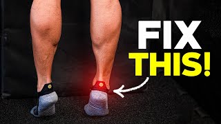 Get Rid of Achilles Pain [upl. by Ibbor114]