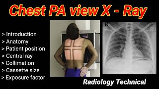 Chest PA View XRay  Posterior to Anterior view  part 1   By BL Kumawat [upl. by Freya505]