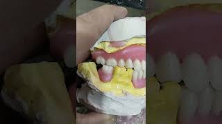 Soft Denture Ready For Try In 😁😁🦷😁😁softdenture dentures dentalartbyhaider [upl. by Nylazor]