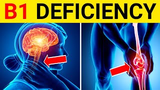 9 Signs and Symptoms of Thiamine Vitamin B1 Deficiency  Thiamine Deficiency Symptoms [upl. by Mussman989]