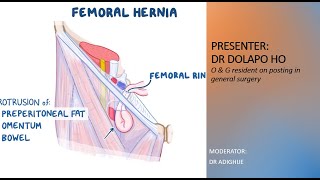 FEMORAL HERNIA [upl. by Lramaj]