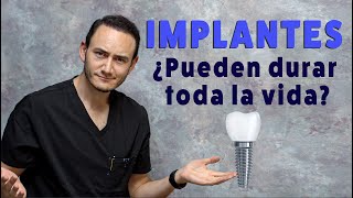 ¿Los Implantes Dentales duran toda la vida  ¿Cuánto tiempo dura un implante dental [upl. by Ainorev]