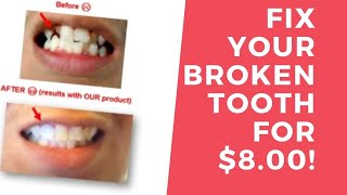 How I fixed my broken tooth for 8 Dollars [upl. by Fawne]