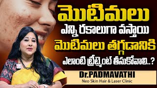 Get rid of pimples and acne In Telugu  DrPADMAVATHI About Pimples  Neo Skin Hair amp Laser Clinic [upl. by Affay]