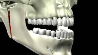 Vertical intraoral [upl. by Clynes]