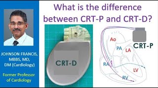 HF3  CRT D System Treating VF Animation [upl. by Menendez]