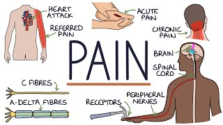 Understanding The Causes of Pain and Pain Management [upl. by Lammaj]