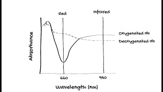 How does Pulse Oximetry work [upl. by Ydahs]