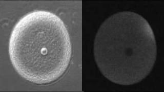 Fertilization  Calcium Wave [upl. by Vashtee]