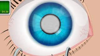 OPERATE NOW  EYE SURGERY  PLAY EYE SURGERY GAME ONLINE [upl. by Acirfa]