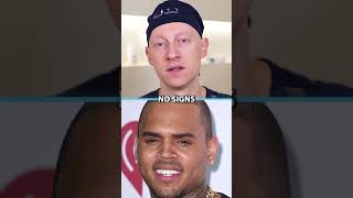 Did Chris Brown Have Plastic Surgery [upl. by Meibers]