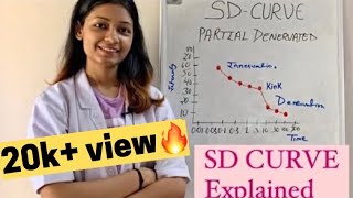 SD Curve in electrotherapy  strength duration curve  physiotherapy  in hindi [upl. by Orian]