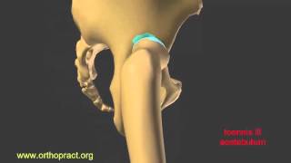 hip dysplasia luxation pseudo acetabulum [upl. by Bud]