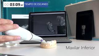 CS 3600 Access Escaneo de Boca Completa en Tiempo Real  Streamhealth Dental [upl. by Lorrie899]