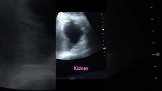 What’s the diagnosis conclusion ultrasoundscans [upl. by Lainad]