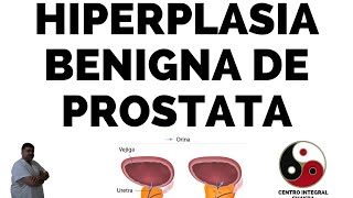 TRATAMIENTO ALTERNATIVO Y NATURAL DE LA HIPERPLASIA BENIGNA DE PROSTATA [upl. by Yanffit]