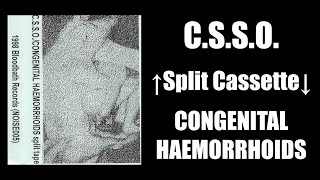 CSSO  CONGENITAL HAEMORRHOIDS Split Cassette Bloodbath 1998 FULL ALBUM  noisecore [upl. by Terrijo]